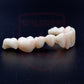 HT white zirconia 71mm system