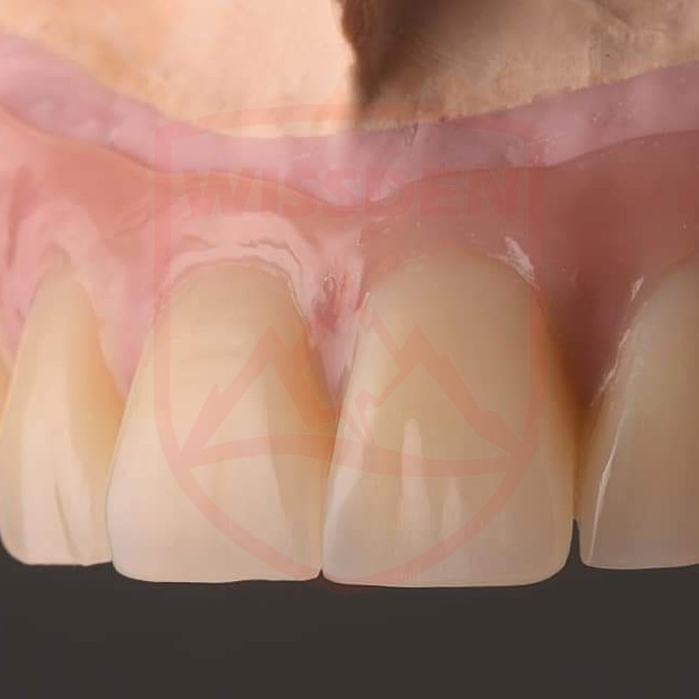 4D Multilayer zirconia 95mm system