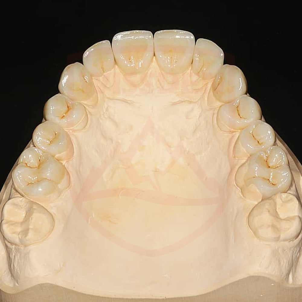 ST-C Pre-shaded zirconia 98mm system