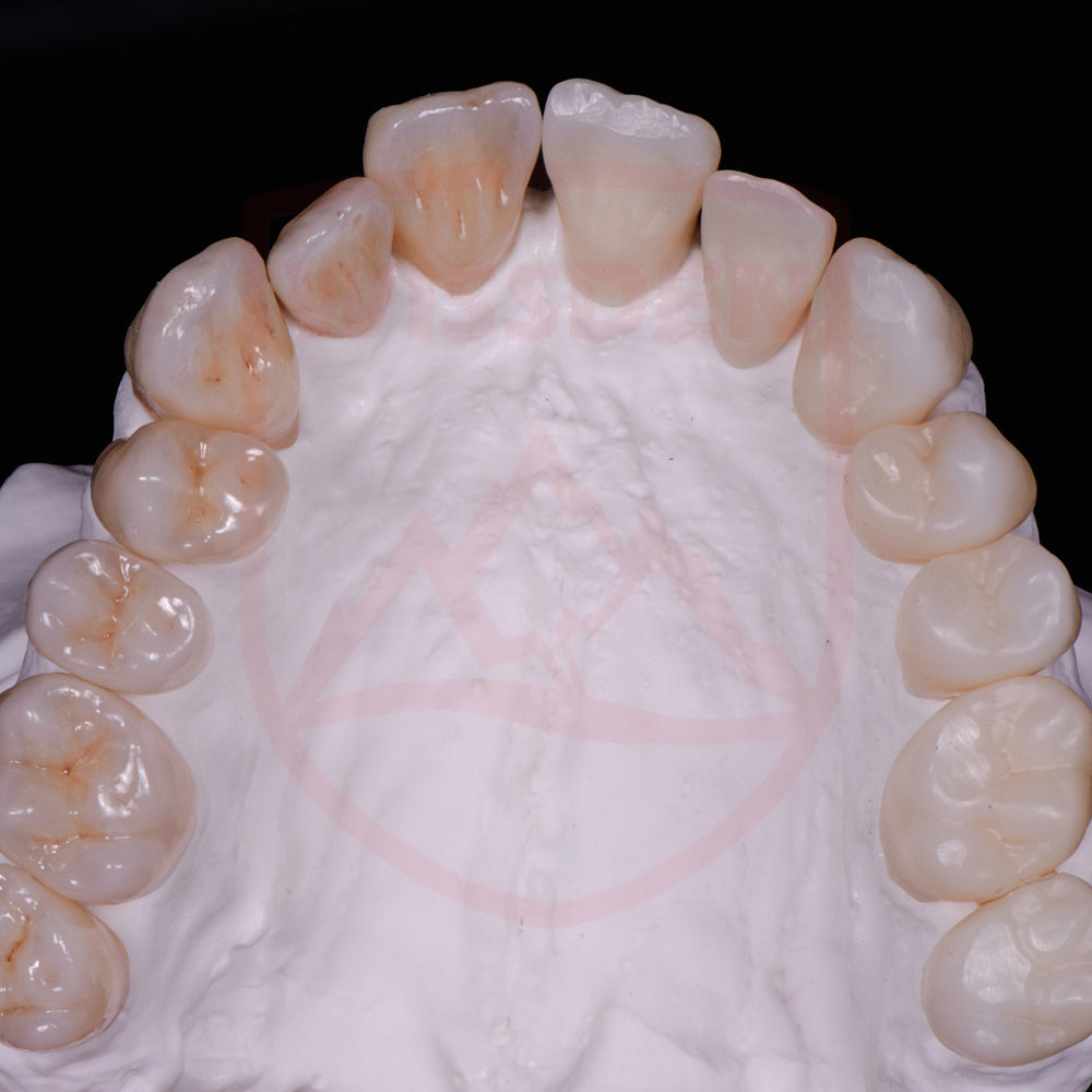 Sistema 3D de circonio multicapa de 71 mm