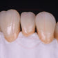 4D Multilayer zirconia 98mm system