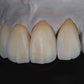 ST-C Pre-shaded zirconia 71mm system