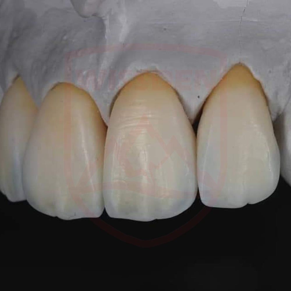 ST-C Pre-shaded zirconia 71mm system